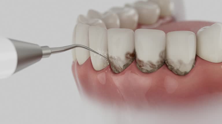 Reliable Dental contractor in Lucedale, MS by Smile Center Dentistry